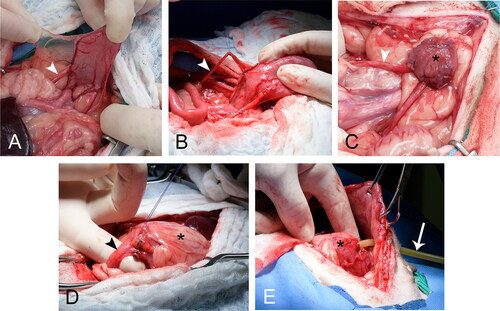 Figure 4. A staged surgical approach was implemented for Group C. This group was meant to represent the more clinically applicable technique of trigono-urethral resection and neoreservoir creation with cystostomy tube. In clinical cases neoureterocystostomy would be required so this was performed in our study. During the first surgery (A-C) the ureters (white arrowhead) were identified and isolated (A-B). Branches of the caudal vesicular artery were ligated as performed in Group B. (C) Ureters were reimplanted into the body of the bladder (asterisk), and the bladder was superficially excoriated and omentalized. Dogs recovered for 2 weeks before the second surgery. During the second surgery (D-E) the omentalized bladder (asterisk) was isolated and transected at the neck (black arrowhead). (E) A cystostomy tube (white arrow) was placed through the neck of the bladder into the newly created neoreservoir. Reimplanted ureters (not visible) remained attached to the neoreservoir. The cystostomy tube exited the lateral body wall and the omentalized neoreservoir (asterisk) was tacked to the body wall.