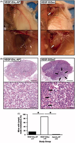 Figure 3. Effect of α2-AP on VEGF-D-driven metastasis to lymph nodes. Axillary lymph nodes from mice harbouring VEGF-D/α2-AP or VEGF-D/Zeo tumours were assessed for tumour cells as described in Materials and Methods. (A) Axillary lymph nodes in mice harbouring VEGF-D/α2-AP tumours were not typically swollen and not readily discernible at macroscopic level whereas a swollen axillary lymph node (indicated by white arrow) from a mouse harbouring a VEGF-D/Zeo tumour is clearly visible. Bottom panels show higher-power images of regions encompassed by black rectangles in upper panels. (B) Histology (H&E staining) showing absence of tumour cells in axillary lymph node from mouse with VEGF-D/α2-AP tumour in contrast to large cluster of tumour cells (indicated by black arrows) in lymph node from mouse with VEGF-D/Zeo tumour. Bottom panels show higher-power images of regions encompassed by black rectangles in upper panels. Large tumour cells located to the right of the arrows in the higher power VEGF-D/Zeo image are apparent. Scale-bars in upper panels denote 400 μm; those in lower panels denote 20 μm. (C) Graph shows proportion of mice from each study group which exhibited lymph node metastasis, including the Apex/α2-AP control study group. * denotes p < 0.01, Fisher’s exact test.