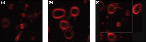 Figure 4 Confocal images illustrating the architecture of liposomes (a and b). Rhodamine 123 was localized into the bilayer structures. c) Three-dimensional projection of liposomes identifying lamellae of multilamellar liposomes.