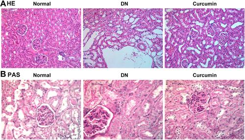Figure 2 The pathological changes of the kidneys after curcumin treatment. (A) HE staining showed the pathological changes in renal. (B) PAS staining the pathological changes in renal.