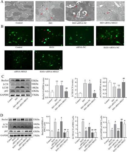 Figure 4. SiRNA-MEG3 inhibits autophagy in murine HF induced by ISO in vivo and H2O2-stimulated H9C2 cells in vitro. (A) Representative images of left ventricular autophagy in mice were obtained by TEM (scale bars: 1 μm). The typical tissue autophagosome is indicated by the red arrow. The higher the number of autophagosomes, the higher the autophagy. (B) Fluorescence representative image of H9C2 cells transfected with GFP-LC3B (scale bar: 50 μm). The red arrow represents free GFP-LC3B and autophagy vacuoles. The more the number, the stronger the autophagy. (C) Western blotting representation image of Beclin1, LC3II/LC3I and p62 proteins in mouse LV and quantitative analysis of Western blotting data. (D) Western blotting representation image of Beclin1, LC3II/LC3I and p62 proteins in H9C2 cells and quantitative analysis of Western blotting data. Data are expressed as mean ± SD. Mice, n = 5; H9C2 cells = 2 batches of cells, 2∼3 multiple wells repeated for each batch of cells. *p < 0.05, **p < 0.01 versus control group; #p < 0.05, ##p < 0.01versus control group.