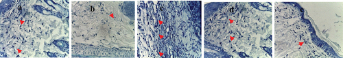 Figure 6. Toluidine blue-stained histopathological slices of rat skin from all the study groups are shown in microstructural analysis (x=40). (a) lesion with no infection has a considerable number of mast cells (red arrows); (b) lesion with bacterial infection with a minimal number of mast cells (red arrows); (c)&; (d)&; (e) lesions with bacterial infection and treated by L. plantarum-ATCC8014 filtrate, solution of L. plantarum-ATCC8014 and chloramphenicol respectively, has a good number of mast cells (red arrows). Where in all groups the mast cells (red arrow) are primarily found in the perivascular space and are crimson purple with several vesicles. Collagen fibers are blue throughout all areas.