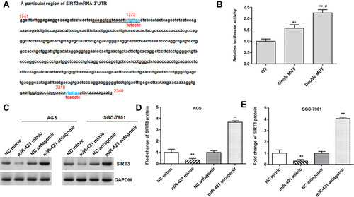 Figure 4 MiR-421 targeted the 3ʹUTR of SIRT3. (A) StarBase 3.0 was used to predict the targeting site of miR-421 and SIRT3. Single and double mutations were performed for SIRT3, and the mutation sites are shown in (A). (B) The relative luciferase activity was tested after single mutation and double-mutated. (C–E) The protein expression of SIRT3 in AGS and SGC-7901 cells was detected after transfected with miR-421 mimic or miR-421 antagomir. GAPDH was used as an internal reference. N=6, **P<0.01, #P<0.01 compared with single MUT.