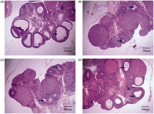 Figure 2. HE staining of follicles of 4 groups of rats. (A) normal control group: Follicles between 200 microns and 400 microns in diameter are evenly distributed in the ovarian cortex; (B) model control group: Almost no follicular development in ovarian cortex; (C) PBS injection group: Almost no follicles in ovarian cortex, and ovarian tissue is damaged to some extent; (D) hUCMSCs transplantation group: The ovarian cortex has follicles between 100 microns and 200 microns in diameter, and the ovarian tissue is partially damaged. The black arrow points to the follicles included in the count. Scale bar: 200 μm.