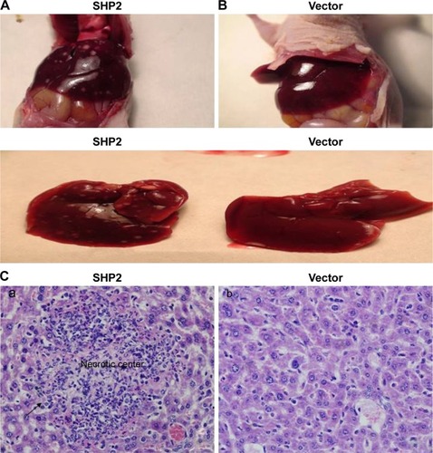 Figure 7 Effect of SHP2 overexpression on tumor metastasis.