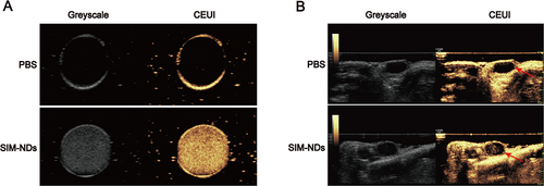 Figure 3 CEUI of SIM-NDs. (A) CEUI of SIM-NDs in vitro. (B) CEUI of SIM-NDs in vivo. The red arrow indicates the position of the tumor.