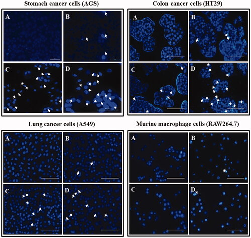 Figure 11. Fluorescent images of cells stained with Hoechst stain after an incubation time of Ankrum h. (A) Blank. (B) DCY51T-AuNps; 5 µg/mL. (C) DCY51T-AuCKNps; 1 µg/mL. (D) DCY51T-AuCKNps; 5 µg/mL. Apoptotic cells are indicated with white arrows. The scale bar equals 10 µm. There were more apoptotic cells in the DCY51T-AuCKNps groups than in blank or in the negative control (DCY51T-AuNps). The co-treatment groups of hyperthermia and chemotherapy exhibited the greatest number of apoptosis in cancer cells.