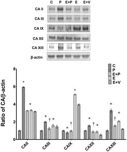 Figure 2. Expression of uterine CA isoenzymes protein in uterus. Representative Western blot images of CA protein bands and the related bar graph showing ratio of CA isoenzymes proteins over β-actin. y-axis represents ratio of the intensity of CA isoenzymes protein bands over the intensity of β-actin protein bands while x-axis represents different CA isoenzymes proteins. The ratio for CA II, III, XII, and XIII over β-actin were highest in progesterone-treated rats while the ratio for CA IX over β-actin was highest in estrogen-treated rats. All data were expressed as mean ± SEM from four independent observations. *p < 0.05 compared to C, †p < 0.05 compared to E + V. C: control, P: progesterone, E: estrogen, V: vehicle (control). Molecular weight for CAII, III, IX, XII, and XIII are 29 kDa, 28 kDa, 58 kDa, 43 kDa, and 30 kDa, respectively.