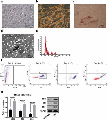 Figure 1. Isolation of hUC-MSCs and hUC-MSC-derived exosomes. a. Observation of hUC-MSC morphology; b. Alizarin red staining of hUC-MSC osteogenic induction; c. Oil red O staining of hUC-MSC adipogenic induction; d. Identification of exosomes by TEM; e. Identification of exosomes by Nanosight; f. Detection of exosome surface antigen by flow cytometry; g. Detection of CD81, CD9 and CD63 expression by Western blot analysis; the data in the figure were measurement data expressed as mean ± standard deviation; comparison between two groups was analyzed by independent sample t-test.