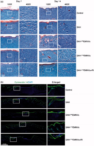 Figure 5. The deposition and remodeling of collagen, and the regeneration of epithelium. (a) Transmitted light images of Masson's trichrome-stained sections of the untreated defects (control) and the defects treated with SAH, SAH-293EMNVs, SAH-H19EMNVs or SAH-H19EMNVs together with RI (BMS-754807) at 7 and 14 days after operation, showing collagen deposition. Scale bar, 100 μm (100×), 25 μm (400×). (b) Immunofluorescence images of cytokeratin 14 (K14) counterstained with DAPI; scale bar, 2 mm.