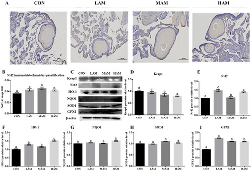 Figure 4. Expression levels of Nrf2 protein immunohistochemistry and antioxidant protein in ovarian tissue of hens. a–dDifferent superscripts have different means (p < 0.05). (A) Nrf2 protein immunohistochemistry, scale bar: 200 μm; (B) immunohistochemical quantification of Nrf2 protein (n = 6); (C–I) Western blot analysis and protein expressions of Keap1, Nrf2, HO-1, NQO1, SOD1 and GPX1 in ovary. Abbreviations: HO-1: haem oxygenase 1; NQO1, NAD(P)H: quinone oxidoreductase 1; SOD1: superoxide dismutase 1; GPX1: glutathione peroxidase 1; Keap1: kelch ECH – associated protein 1; Nrf2: nuclear factor E2-related factor 2. CON, LAM, MAM and HAM, basal diets supplemented with 0, 1, 4 and 7% of Aronia melanocarpa (AM), respectively.