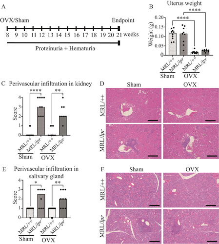 Figure 1. Ovariectomy (OVX) does not affect perivascular leucocyte infiltration in the kidneys or salivary glands of MRL/lpr mice. MRL/lpr mice and their congenic control strain (MRL/++) were subjected to sham surgery or OVX at 8 weeks of age and perivascular infiltration was analysed in whole sections of kidney and salivary gland. The severity was scored according to a 0–4 grade scale. (A) Schematic overview of the experimental set-up; (B) uterus weight; (C) perivascular leucocyte infiltration score in the kidney and (D) representative images of kidney infiltrations; (E) perivascular leucocyte infiltration in the salivary gland and (F) representative images of salivary gland infiltrations. Each data point represents an individual animal. The bars indicate the median (B) or median (C and E). Statistical analysis: one-way ANOVA followed by Sidak’s post-hoc analysis (B) or Kruskal–Wallis followed by Dunn’s multiple comparison test (C and E). *p < 0.05, **p < 0.01, ****p < 0.0001. Scale bar = 200 µm.