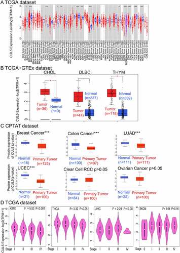 Figure 1. We analyzed various databases to obtain cullin-5 (CUL5) expression data. (a) TIMER2 analysis indicated that different cancers and specific cancer subtypes affect the CUL5 gene expression status. Samples with gray backgrounds represent both tumor and normal tissue samples, which can be compared statistically. Samples with white backgrounds represent only tumor samples, which cannot be compared statistically (*P < 0.05; **P < 0.01; ***P < 0.001). (b) We used normal tissue data on CHOL (cholangiocarcinoma), DLBC (diffuse large B cell lymphoma), and THYM (thymoma) from the Genotype-Tissue Expression database as controls for comparisons with the corresponding data from The Cancer Genome Atlas (TCGA) project, which are presented as a box plot (*P < 0.05). (c) Expression levels were also compared between tumor tissue and normal tissue of CUL5 proteins in breast cancer, colon cancer, LUAD (lung adenocarcinoma), UCEC (uterine corpus endometrial carcinoma), clear cell renal cell carcinoma, and ovarian cancer based on the CPTAC data set (***P < 0.001). (d) We analyzed the prime pathological stages (stages I to IV) to identify CUL5 gene expression levels for ACC (adrenocortical carcinoma), THCA (thyroid carcinoma), LIHC (liver hepatocellular carcinoma), and SKCM (skin cutaneous carcinoma) based on TCGA data. The logarithmic scale was produced using log2 TPM + 1