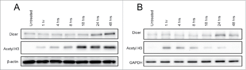 Figure 2. Dicer protein expression over 48 h of Panobinostat treatment. A. JAR cells treated with 25 nM Panobinostat over the course of 48 h were harvested and probed for expression of Dicer, acetylated histone 3, and β-actin via Western blot. B. JAR cells treated with 25 nM Trichostatin A over the course of 48 h were harvested and probed for expression of Dicer, acetylated histone 3, and GAPDH via Western blot. The data represent two independent experiments.