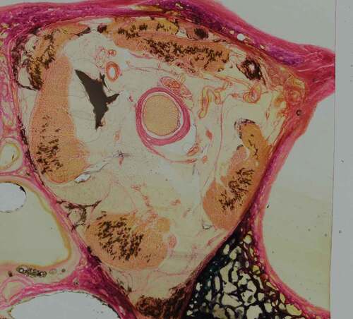 Figure 2. Coronal orbit section stained with modified Gomori’s trichrome stain with Wiegert’s haematoxylin