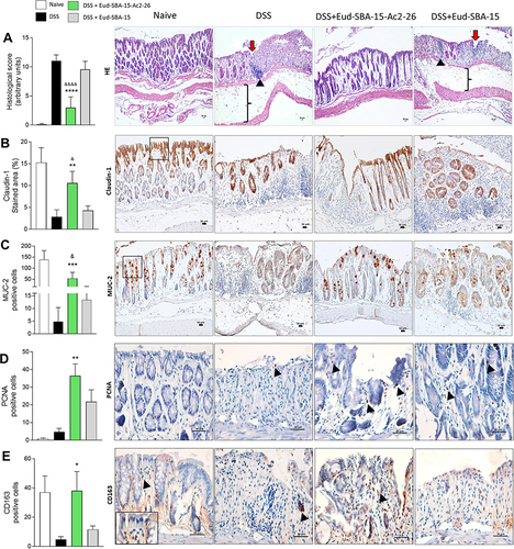 Figure 5 Histopathological sections performed with HE dyes. (A) Histopathological score represented by arbitrary units. The sections were blindly evaluated and considered alterations were highlighted. Tissue edema (square brackets), inflammatory infiltrates (black arrow head) and ulcerations (red arrow). Naïve section presenting normal histoarchitecture. Mice colon sections submitted to IHC. (B) Representative sections and percentage (%) of marked area for Claudin-1 marker. Black square represents the apical region. (C) Representative sections and, number of positive cells per field for MUC-2 marker. Black square represents the apical region. (D) Representative sections and, number of positive cells per slide for PCNA marker. Black arrow heads indicating positive cells. (E) Representative sections and number of positive cells per field for CD163 marker. Black arrow heads indicating positive cells. n = 10 mice/group. Scale bar: 50 μm. Sections: 4 μm. *p < 0.05, **p < 0.01, ***p< 0.001, ****p < 0.0001 vs DSS. &p < 0.05, &&&&p < 0.0001 vs DSS + Eudragit-SBA-15.