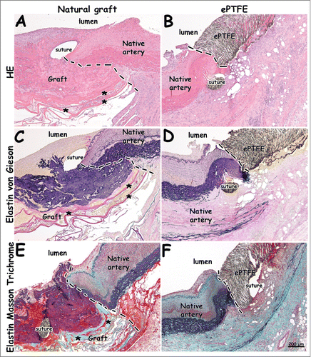 Figure 5. Histological images from distal anastomoses 1 week after surgery. Distinct anastomotic sites and patent grafts are visible. The natural graft's elastin layer is shown in black/blue (C, E). Please note continuity between elastin layering of the natural graft and elastin of the native vessel (E). Lamellae of the type I collagen film are seen in pink (A, C) and green (E), and indicated by asterisks (*). (A-B) H&E staining. (C-D) Elastin von Gieson staining (collagen: pink, elastin: blue/black). (E-F) Elastin Masson Trichrome staining (collagen: green, elastin: black, red: fibrin, cells). Dotted lines indicate anastomoses. Bar represents 200 µm.
