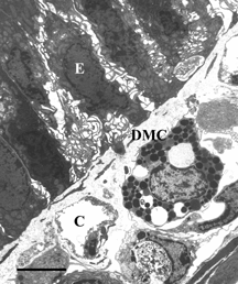 Figure 8 Electron microscopy of intestinal mucosa to assess epithelial damage. Typical electron micrograph of transverse section through intestinal villus (Peyers' patch area) from rat that had been injected with 1 mg PS-ODN in 0.5 ml, followed 2 minutes later by 50 mg DBBF-Hb in 5 ml. The experiment was terminated 30 minutes after the DBBF-Hb injection. Unlike the villi from animals injected with HBS-2% BSA for 2 minutes followed by DBBF-Hb for 30 minutes (Figure 7), the villous epithelial cells (E) are separated from each other and show extensive cytoplasmic protuberances. A degranulated mast cell (DMC) is visible. Thus pretreatment with PS-ODN appears to inhibit epithelial repair of villi adjacent to Peyer's patches. Scale bar: 5 microns.