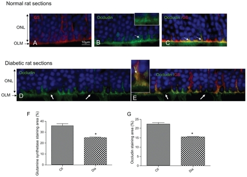 Figure 3 Occludin is expressed and colocalized with glutamine synthetase at the OLM. GS red (A) and occludin green (B) merged (C). Note de decrease of both occludin and GS staining in hyperglycemic conditions (D, E). GS (F) and occludin (G) immunohistochemistry staining quantification.