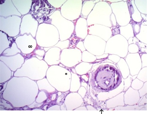 Figure 4 Hematoxylin and eosin stain, magnification 200×.