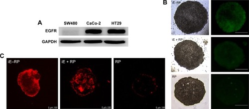 Figure 3 Investigation of the total EGFR expression levels in three different colorectal cancer cell lines as well as cellular uptake of iE–RBCm–PLGA NPs and penetration in MCS.Notes: (A) Western blot analysis of the whole cell line lysates for EGFR and GAPDH. (B) Images of HT-29 MCS incubated with DiO-labeled iE–RBCm–PLGA NPs (iE–RP), RBCm–PLGA NPs with free anti-EGFR-iRGD protein (iE + RP), and RBCm–PLGA NPs (RP) for 4 h under inverted fluorescence microscope; scale bar =100 µm. (C) CLSM images of HT-29 MCS incubated with DiI-labeled iE–RBCm–PLGA NPs (iE–RP), RBCm–PLGA NPs with free anti-EGFR-iRGD protein (iE + RP), and RBCm–PLGA NPs (RP) for 4 h; scale bar =100 µm.Abbreviations: CLSM, confocal laser scanning microscopy; DiO, 3,3′-dioctadecyloxacarbocyanine perchlorate; EGFR, epidermal growth factor receptor; MCS, multicellular spheroids; NPs, nanoparticles; PLGA, poly(lactic-co-glycolic acid); RBCm, red blood cell membrane.