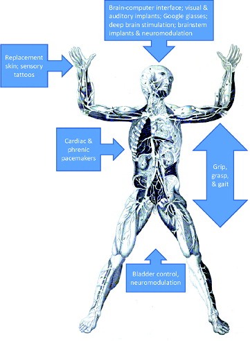 FIGURE 2. Neural enhancement technologies for rehabilitation that could also be used to exceed the range of typical human functional ability. Inspired by Stieglitz (Citation2007).