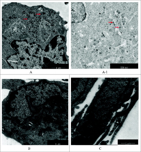 Figure 6. Retrovirus tests of Walvax-2. The results were observed by mirror electron microscopy(200Kv 5000x/160Kv 7800x). The arrows point to virus particles detected as shown in the picture. (A) and (A-1) were represented positive controls (Sp2/0-Ag14), (A-1) was partial enlarged detail of (A). (B) was represented negative control (MRC-5). (C) was represented the cells of Walvax-2 of the 24th passage.
