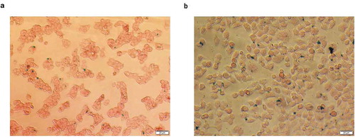 Figure 7. Cell uptake of LP-PEI-SPION/pGL3 complexes. Representative Prussian blue staining micrographs show obvious uptake of nanoparticles. Prussian blue staining images after 4 h of incubation with LP-PEI-SPION/pGL3 complexes at the weight ratio of 6 in (a) HepG2 and (b) SPC-A1.