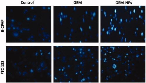 Figure 6. Nuclear staining of B-CPAP and FTC-133 thyroid cancer cell lines after treatment with GEM and GEM-NPs (IC50 concentration) for 24 h.