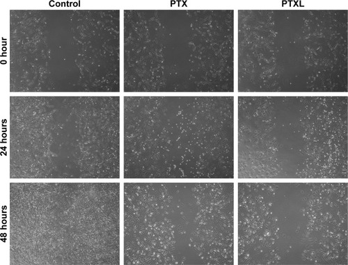 Figure 6 Wound healing images of HKFs within 48 hours (magnification: ×40).Abbreviations: HKFs, human keloid fibroblasts; PTX, paclitaxel; PTXL, paclitaxel–cholesterol-loaded liposomes.