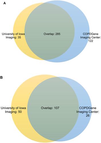 Figure 1 Overlap of discordant groups from comparisons of University of Iowa radiologists versus quantitative computed tomography (QCT) and COPDGene radiologists versus QCT. (A) Visual-only emphysema. (B) Quantitative-only emphysema.