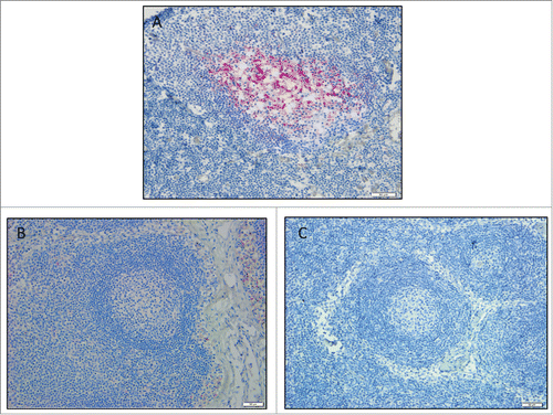 Figure 1. Coyote lymph node immunohistochemistry. Images are a representation of findings. (A) CWD-positive control elk retropharyngeal lymph node. Control coyote (B), and treatment coyote (C), retropharyngeal lymph node. 20X magnification.