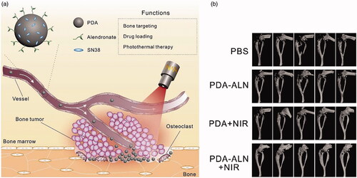 Figure 3. (a) Illustration of bone-targeted NPs with chemo-photothermal treatment. (b) 3D micro-CT reconstruction image of the tumor-bearing tibias after several treatment (Wang, Huang, et al., Citation2018).