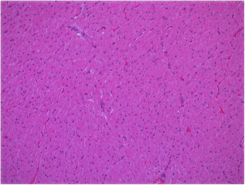 Fig. 1 Normal-structured myocardial tissue fibers in the control group, HEx200.