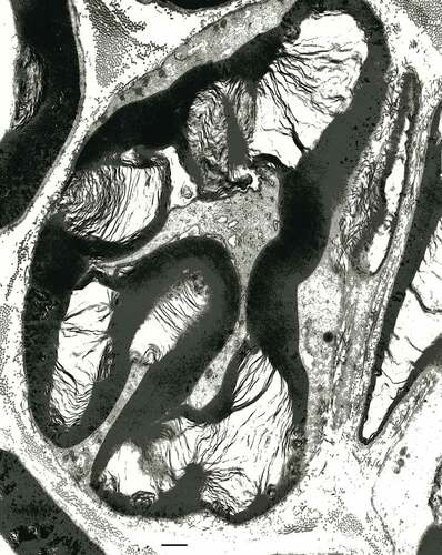 Figure 15. Near nodal region of an obese Zucker fa/fa rat sciatic nerve fiber. This typical folded region of a myelinated fiber demonstrates apparent myelin adhesion defects not so different that typical node fine structure but appear as large, loosened, open onion-like sectors along with interstices of obliquely-cut tight myelin appears packed, as electron dense stripes. The axoplasm content is vacuolated and the myelin depicts a large star-shaped overall aspect due to partial unwrapping of the myelin layers near the Ranvier node. Scale is 1 µm.