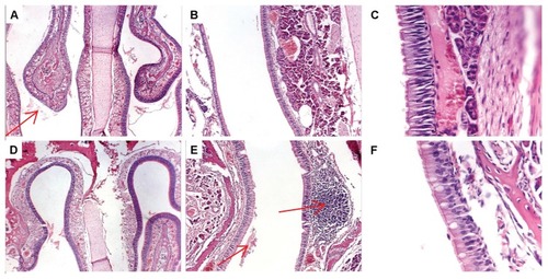Figure 5 Histopathology of rat nasal tissues after three intranasal doses of (A–C) dendriplexes in buffer or (D–F) dendriplexes within in situ-forming poloxamer/carbopol gel. (A and D) magnification ×40, (B and E) magnification ×100, (C and F) magnification ×400 (respiratory epithelium). Arrows showed luminal exudates (A and E) and normal lymphatic infiltration (E).