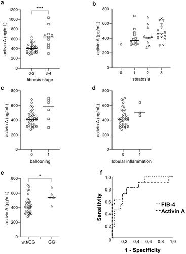 Figure 1. Circulating plasma levels of activin A in patients according to the (a) fibrosis stage (F0-2, n = 30; F3-4, n = 11), (b) steatosis grade (0, n = 1; 1, n = 12; 2, n = 10; 3, n = 16), (c) ballooning grade (0, n = 33; 1, n = 6) and (d) lobular inflammation grade (0, n = 36; 1, n = 3). (e) Circulating plasma levels of activin A in patients with PNPLA3 wild type (w.t) or heterozygote C/G allele (n = 33) compared to patients with the homozygote G/G allele (n = 5). * for p < 0.05, *** for p < 0.001. Data are presented as individual values and medians. (f) Receiver Operating Characteristic (ROC) curve demonstrating the performance of FIB-4 and Activin A in detecting the presence of advanced fibrosis. Activin A AUROC = 0.836 and FIB-4 AUROC = 0.839.