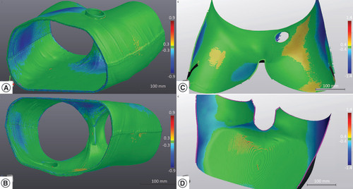 Figure 4. Surface deviation of the immobilization device. (A & B) Surface mapping of the material accuracy of the 3D-printed device for the first volunteer. (C & D) Surface mapping of the material accuracy of the 3D-printed device for the second volunteer. The VxElements™ platform visualizes surface deviations between the numerical device model and the 3D-surface scan of the real object.