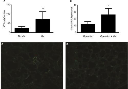 Figure 3 (A) Average numbers of visible GFP-4T1 cells in individual mouse lung were counted and are presented as mean±SD, n=8. The * indicates statistical significance, P<0.05. (B) Average numbers of visible 4T1 metastatic nodules in individual mouse lung were counted and are presented as mean±SD, n=6. The * indicates statistical significance, P<0.05. (C) Low-power (×10) photomicrograph of lung frozen sections from BALB/c mouse in the control group (24 h after intravenously injection of 1×105 GFP-labeled 4T1 cells without MV, Protocol A) shows GFP-labeled 4T1 cells scattered within the lung parenchyma. (D) Photomicrograph (×10) of lung frozen sections from BALB/c mice (24 h later, treated with MV when the tail vein was injected with 1×105 GFP-labeled 4T1 cells, Protocol A). Note the minimal interstitial edema and GFP-labeled 4T1 cells diffusely exist within injured lung parenchyma.Abbreviations: d, days; GFP, green fluorescent protein; h, hours; MV, mechanical ventilation.