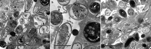 Figure 5. Transmission electron micrographs of CAs produced by B. pseudobassiana after 24 h post-incubation on water agar plates. A. CA ultrathin section showing numerous cells in lytic process and dead cells (arrows). B. CA cells with heavy deposits of melanising material. C. CA ultrathin section showing hyphae (Hy) with septums (S). Outer layer (OL), internal membrane (IM), extracellular matrix (EM), lipid (L), melanin deposit (m)