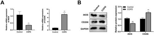 Figure 3. Detection of the expression levels of M1 and M2 macrophage markers, iNOS and CD206 in Control and COPD group by RT-qPCR (A) and western blotting (B). **p < .01 vs. control.