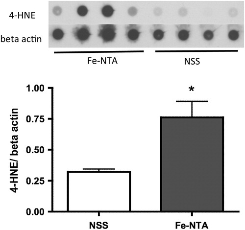Figure 3. Dot blot analysis of the hippocampus after continuous injection of Fe-NTA for 2 weeks. The levels of 4-HNE were normalized with beta-actin. Fe-NTA raised the levels of 4-HNE significantly (n = 4, *P < 0.05).