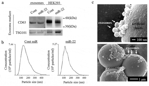 Figure 1. The exosome confirmation analysis. The exosomes were isolated from the culture medium of HEK293 cells transfected with either precursor miR-22 (miR-22) or control (cont miR). (a) Western blot analyses were performed to detect the exosomal marker proteins (CD63 and TSG101) in vesicles released by HEK293 cells. Representative examples of bands from three independent experiments are shown. (b) The particle size distributions and concentrations of exosomes were measured using a nanoparticle tracking system. (c) A representative image of exosomes using transmission electron microscopy