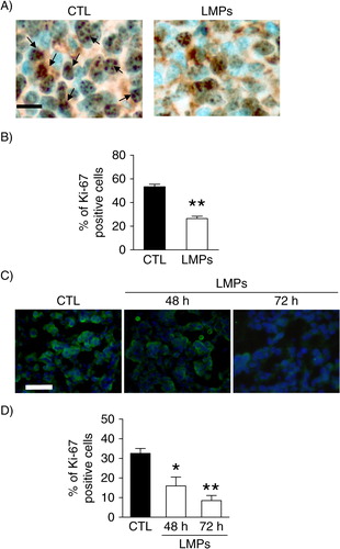 Fig. 4.  LMPs inhibit tumour cell proliferation in vivo and ex vivo. (A) Representative images of Ki-67 immunostaining of paraffin-fixed LLC tumour sections. Indirect immunoperoxidase staining was performed with rabbit monoclonal anti-mouse Ki-67. Arrows indicate Ki-67-positive cells, which exhibited brown nuclei. Bar, 30 µm. (B) Cell proliferation was determined as the mean percentage of Ki-67-positive nuclei per 1,000 cells. (C) Representative pictures of Ki-67 immunostaining in human breast cancer explants treated with or without LMPs. Green florescence indicated the Ki-67-positive cells. (D) Graph illustrating the Ki-67 score for control (CTL) and LMP-treated cells. *P<0.05, **P<0.01 vs. CTL.