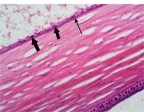 Figure 4 Photomicrograph of an experimental rabbit’s cornea showing normally appearing flat endothelial cells (thick arrow) and intact Descemet’s membrane (thin arrow). Hematoxylin and eosin staining, 400×.