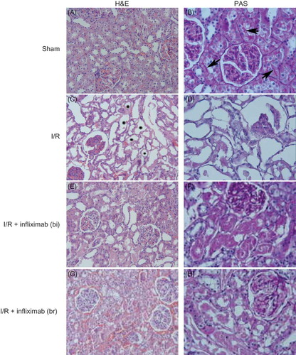 Figure 1. (A) Sham; renal tubules and glomeruli are intact. H&E ×66. (B) Sham; appearance of brush border (arrows). PAS ×132. (C) I/R group; tubules show diffuse and marked necrosis (*). H&E ×66. (D) I/R group; notice lost of the brush border and glomerular changes. PAS ×132. (E) I/R + infliximab (bi); despite tubular degeneration are visible in some area, glomeruli are seen intact. H&E ×66. (F) I/R + infliximab (bi); the loss of brush border was marked in affected tubules. PAS ×132. (G) I/R+ infliximab (br); moderate tubular damage and interstitial congestion are observed. H&E ×66. (H) I/R+ infliximab (br); the view of brush border is similar to ischemia group. PAS ×132.