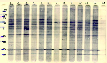 Figure 1. Representative Western blot of plasma samples from calves of different age and fed different diets for the IgM isotype (separate lanes represent individual plasma samples). There are qualitative similarities of the conserved staining pattern in the samples but with quantitative differences. The most left lane represents molecular weight markers. Lanes 1 and 3: restricted diet, 20 weeks of age; lanes 2 and 4: restricted diet, 26 weeks of age; lanes 5, 7, 9, and 11: ad libitum diet, 20 weeks of age; lanes 6, 8, 10, and 12: ad libitum diet, 26 weeks of age. The most left lane represents molecular weight (kiloDalton) markers. The most right lane (13) in which no serum was incubated represents the conjugate (sheep anti-bovine IgM/PO) control.