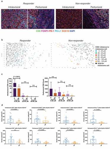 Figure 1. Spatial profiling of responders and non-responders treated with anti-PD-1 monotherapy. (a) Representative multiplex immunofluorescent images of intratumoral and peritumoral regions stained with CD8, FOXP3, PD-1, PD-L1, SOX10 and DAPI, from a responder and non-responder to anti-PD-1 alone. (b) Scatter plots illustrating the number of CD8+ immune cells within proximity to a melanoma cell at 20 µM intervals, in a single representative image from a responding and non-responding patient. (c) Bar graphs showing the differences in the number of intratumoral and peritumoral CD8+ cells within proximity to a SOX10+ melanoma cell between responders and non-responders at 20 µM intervals. (d) Box plots comparing the number of immune cells within 20 µM of a SOX10+ tumor cell in responders and non-responders. Error bars represent SD