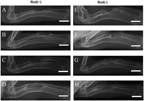 Figure 9. DR images of longitudinal sections of rabbit radius defects with (A–D) and without (E–H) X-ray irradiation 12 weeks after the application of empty PLGA/GMs scaffolds (control) (A and E), PLGA/GMs scaffolds containing bone marrow (BM) (B and F), BMP-2-releasing PLGA/GMs scaffolds (BMP) (C and G), and BMP-2-releasing PLGA/GMs scaffolds with bone marrow (BM/BMP) (D and H). Scale bars correspond to the length of 20 mm.