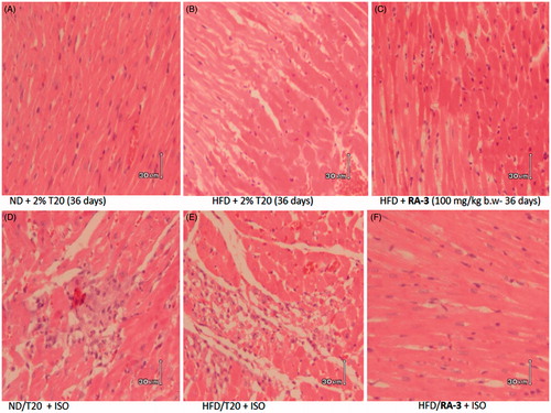Figure 2. Histological changes (200× magnification) of the heart tissues from rats following ISO-induced myocardial injury. The rats were fed on (A) ND and (B,C) HFD for 36 days, with the (C) experimental group being pretreated with RA-3 for 15 days, (D–F) before they received a subcutaneous injection of ISO (85 mg/kg) to induce myocardial injury.